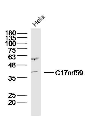 Fig1: Sample:Hela Cell(Human) Lysate at 40 ug; Primary: Anti-C17orf59 at 1/300 dilution; Secondary: IRDye800CW Goat Anti-Rabbit IgG at 1/20000 dilution; Predicted band size: 37kD; Observed band size: 40kD