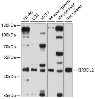 Western blot - KIR3DL2 Polyclonal Antibody 