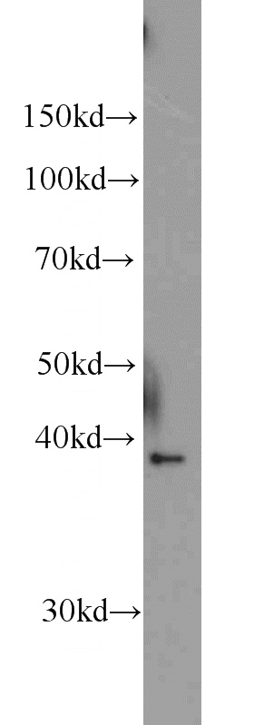A2780 cells were subjected to SDS PAGE followed by western blot with Catalog No:109464(COPS4 antibody) at dilution of 1:500