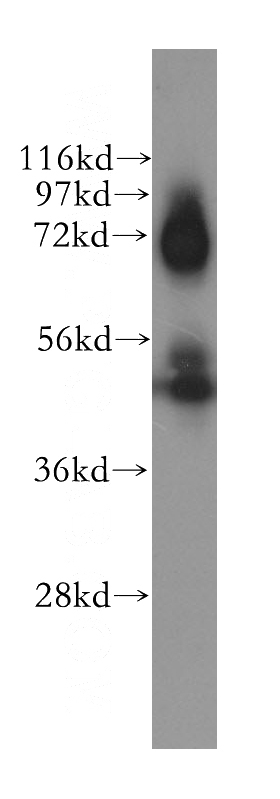 Y79 cells were subjected to SDS PAGE followed by western blot with Catalog No:109410(CLU antibody) at dilution of 1:300