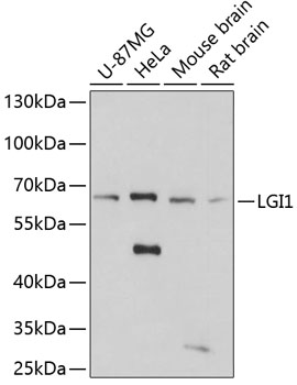 Western blot - LGI1 Polyclonal Antibody 