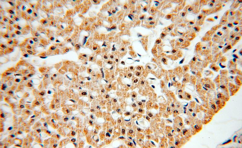 Immunohistochemical of paraffin-embedded human heart using Catalog No:113620(KAT2B antibody) at dilution of 1:50 (under 40x lens)