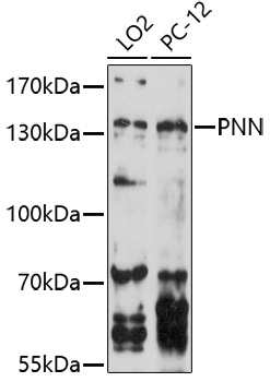 Western blot - PNN Polyclonal Antibody 