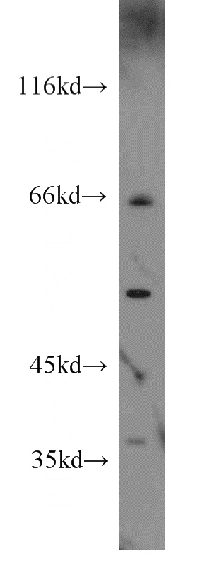 Raji cells were subjected to SDS PAGE followed by western blot with Catalog No:111431(HLA-F antibody) at dilution of 1:1000