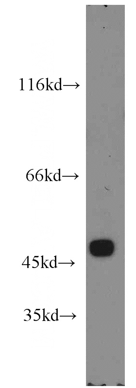 mouse testis tissue were subjected to SDS PAGE followed by western blot with Catalog No:115935(TEKT1 antibody) at dilution of 1:1000
