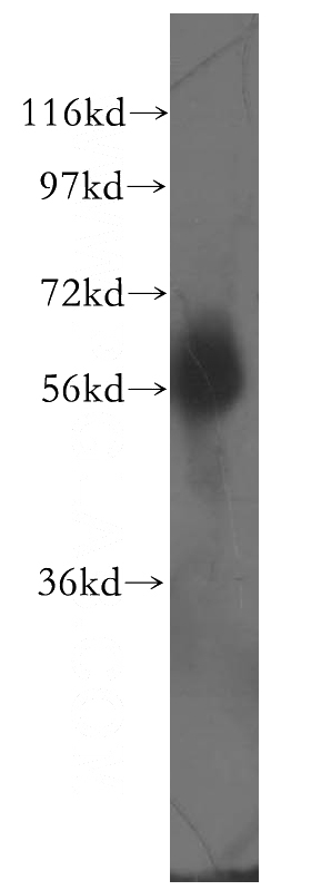 HeLa cells were subjected to SDS PAGE followed by western blot with Catalog No:109753(DCLRE1C antibody) at dilution of 1:400