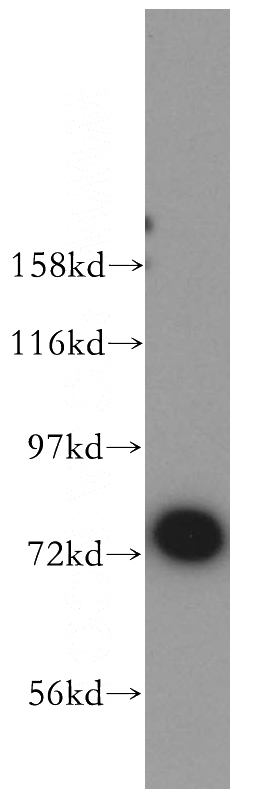 mouse spleen tissue were subjected to SDS PAGE followed by western blot with Catalog No:111880(JAKMIP1 antibody) at dilution of 1:800