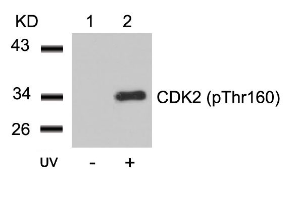 Western blot analysis of extracts from Hela cells untreated (lane 1) or treated with UV (lane 2) using CDK2 (Phospho-Thr160) Antibody .