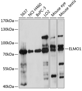 Western blot - ELMO1 Polyclonal Antibody 