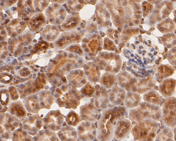 Fig7:; Immunohistochemical analysis of paraffin-embedded mouse kidney tissue using anti-cGAS antibody. The section was pre-treated using heat mediated antigen retrieval with sodium citrate buffer (pH 6.0) for 20 minutes. The tissues were blocked in 5% BSA for 30 minutes at room temperature, washed with ddH; 2; O and PBS, and then probed with the primary antibody ( 1/200) for 30 minutes at room temperature. The detection was performed using an HRP conjugated compact polymer system. DAB was used as the chromogen. Tissues were counterstained with hematoxylin and mounted with DPX.