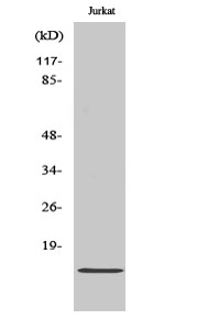 Fig1:; Western Blot analysis of various cells using Cdc42EP5 Polyclonal Antibody diluted at 1: 500