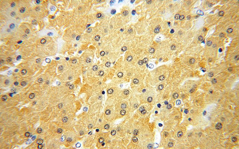 Immunohistochemical of paraffin-embedded human liver using Catalog No:111446(HPD antibody) at dilution of 1:100 (under 40x lens)