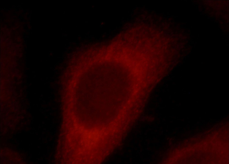 Immunofluorescent analysis of HepG2 cells, using NCRNA00153 antibody Catalog No:108696 at 1:25 dilution and Rhodamine-labeled goat anti-rabbit IgG (red).