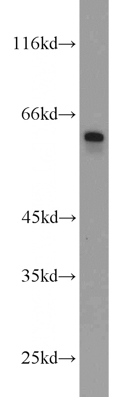 L02 cells were subjected to SDS PAGE followed by western blot with Catalog No:117107(BCO2 antibody) at dilution of 1:800