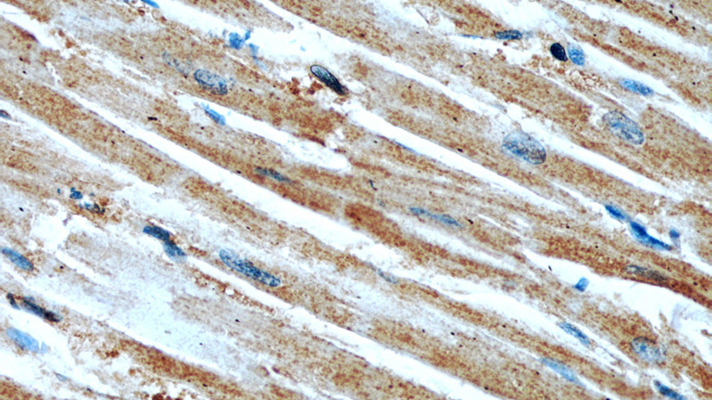 Immunohistochemical of paraffin-embedded human heart using Catalog No:107293(GEFT antibody) at dilution of 1:50 (under 40x lens)