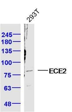 Fig1: Sample: 293T Cell (Human) Lysate at 40 ug; Primary: Anti-ECE2 at 1/300 dilution; Secondary: IRDye800CW Goat Anti-Rabbit IgG at 1/20000 dilution; Predicted band size: 80-100 kD; Observed band size: 80 kD