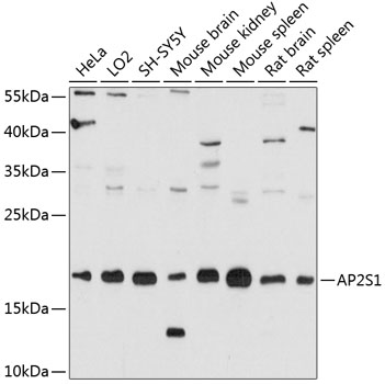 Western blot - AP2S1 Polyclonal Antibody 