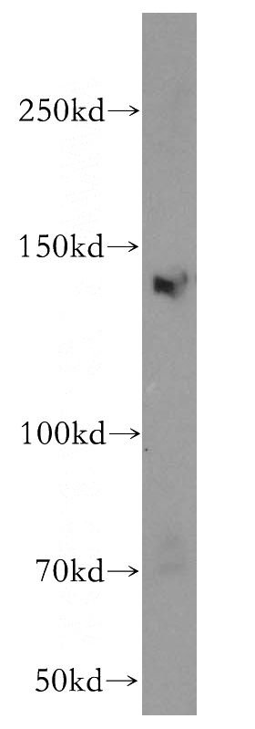 HeLa cells were subjected to SDS PAGE followed by western blot with Catalog No:112025(KDM3A,JMJD1A antibody) at dilution of 1:2000