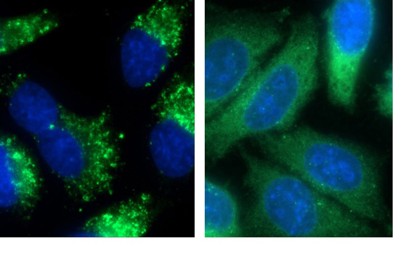Immunofluorescent analysis of (-20oc Ethanol) fixed Starvation treated HepG2 cells using Catalog No:113557(P62;SQSTM1 Antibody) at dilution of 1:50 and Alexa Fluor 488-congugated AffiniPure Goat Anti-Rabbit IgG(H+L)