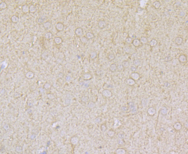 Fig2: Immunohistochemical analysis of paraffin-embedded rat brain tissue using anti-ACCN2 antibody. Counter stained with hematoxylin.