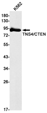 Western blot detection of TNS4/CTEN in K562 cell lysates using TNS4/CTEN Rabbit mAb(1:1000 diluted).Predicted band size:77kDa.Observed band size:90kDa.