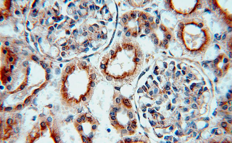 Immunohistochemical of paraffin-embedded human kidney using Catalog No:114749(RNF181 antibody) at dilution of 1:100 (under 40x lens)