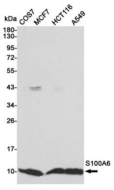 Western blot detection of S100A6 in COS7,MCF7,HCT116 and A549 cell lysates using S100A6 mouse mAb (1:1000 diluted).Predicted band size:10KDa.Observed band size:10KDa.