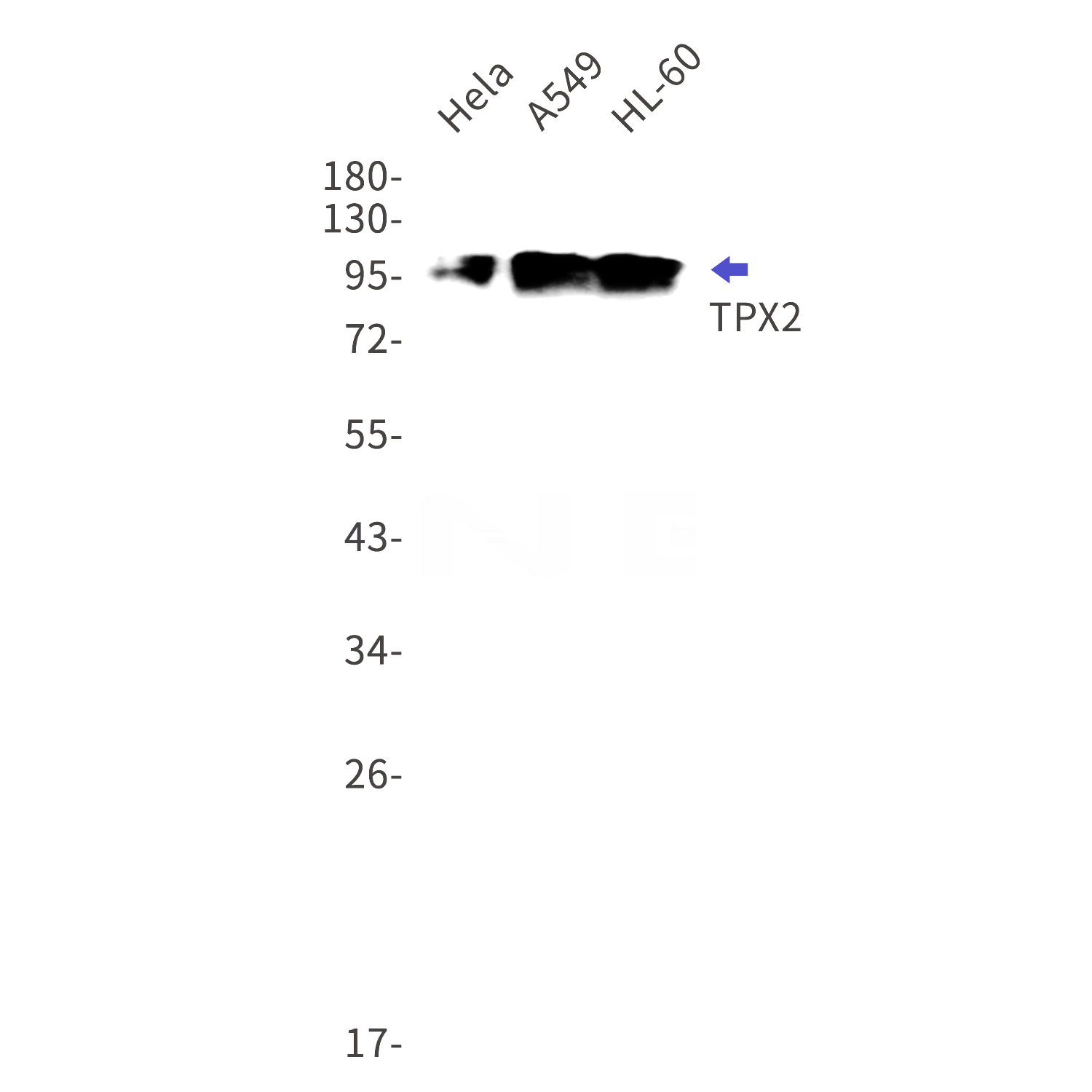 Western blot detection of TPX2 in Hela,A549,HL-60 cell lysates using TPX2 Rabbit mAb(1:1000 diluted).Predicted band size:86kDa.Observed band size:100kDa.