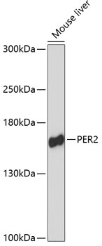 Western blot - PER2 Polyclonal Antibody 