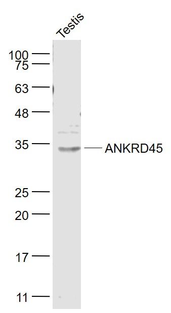Fig2: Sample:; Testis (Mouse) Lysate at 40 ug; Primary: Anti- ANKRD45 at 1/1000 dilution; Secondary: IRDye800CW Goat Anti-Rabbit IgG at 1/20000 dilution; Predicted band size: 32 kD; Observed band size: 32 kD