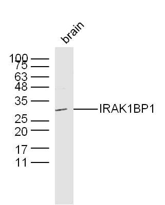 Fig2: Sample:; Brain (Mouse) Lysate at 40 ug; Primary: Anti-IRAK1BP1 at 1/300 dilution; Secondary: IRDye800CW Goat Anti-Rabbit IgG at 1/20000 dilution; Predicted band size: 29 kD; Observed band size: 29 kD