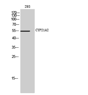 Fig1:; Western Blot analysis of 293 cells using CYP21A2 Polyclonal Antibody diluted at 1: 1000