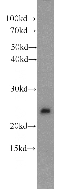 Jurkat cells were subjected to SDS PAGE followed by western blot with Catalog No:114022(PMF1 antibody) at dilution of 1:400