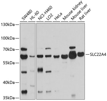 Western blot - SLC22A4 Polyclonal Antibody 