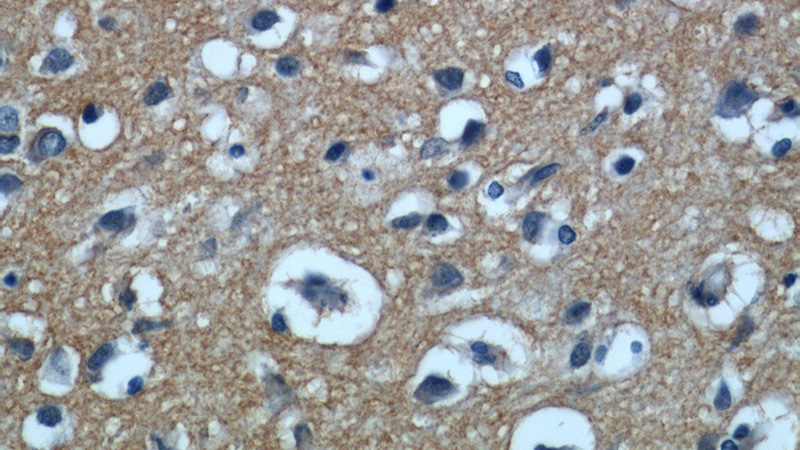 Immunohistochemical of paraffin-embedded human brain using Catalog No:110159(SLC1A1 antibody) at dilution of 1:50 (under 40x lens)