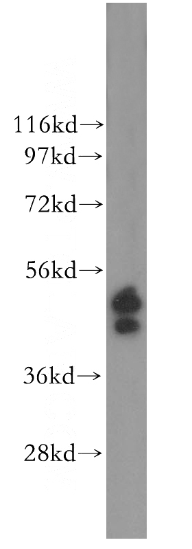 HeLa cells were subjected to SDS PAGE followed by western blot with Catalog No:110371(ERO1LB antibody) at dilution of 1:500