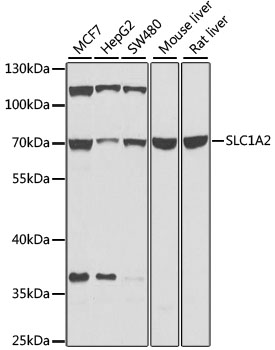 Western blot - SLC1A2 Polyclonal Antibody 