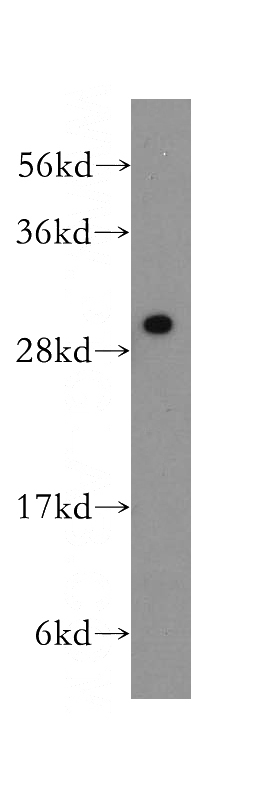 human colon tissue were subjected to SDS PAGE followed by western blot with Catalog No:114248(PSME3 antibody) at dilution of 1:500