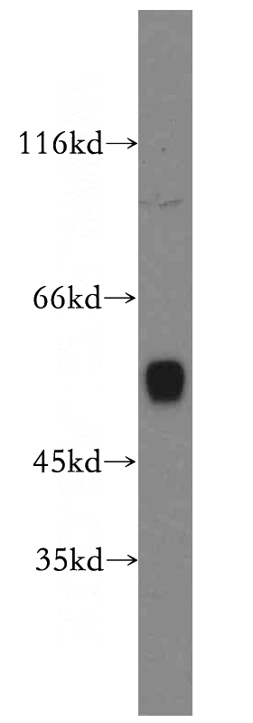 mouse liver tissue were subjected to SDS PAGE followed by western blot with Catalog No:109684(CYP1A2-Specific antibody) at dilution of 1:1000