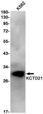 Western blot detection of KCTD21 in K562 cell lysates using KCTD21 Rabbit pAb(1:1000 diluted).Predicted band size:30kDa.Observed band size:30kDa.