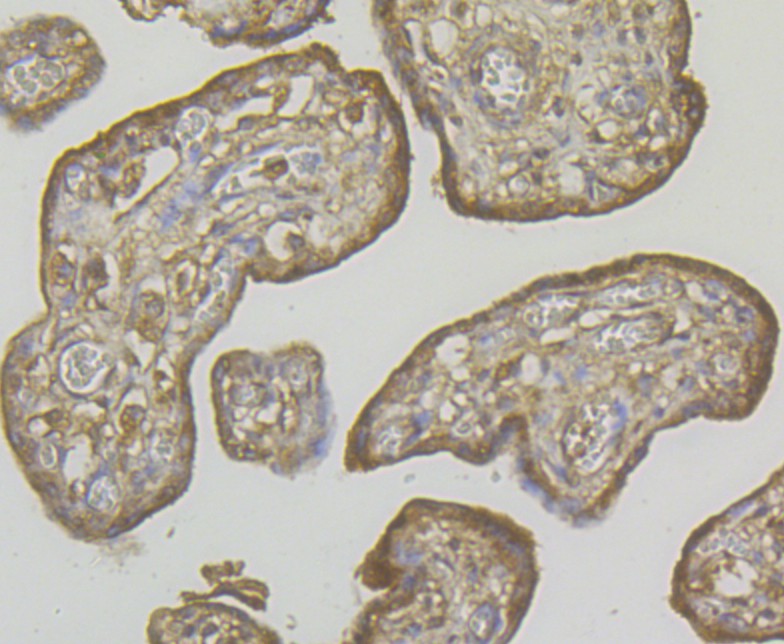Fig5: Immunohistochemical analysis of paraffin-embedded human placenta tissue using anti-RYR3 antibody. The section was pre-treated using heat mediated antigen retrieval with Tris-EDTA buffer (pH 8.0-8.4) for 20 minutes.The tissues were blocked in 5% BSA for 30 minutes at room temperature, washed with ddH2O and PBS, and then probed with the antibody at 1/200 dilution, for 30 minutes at room temperature and detected using an HRP conjugated compact polymer system. DAB was used as the chrogen. Counter stained with hematoxylin and mounted with DPX.