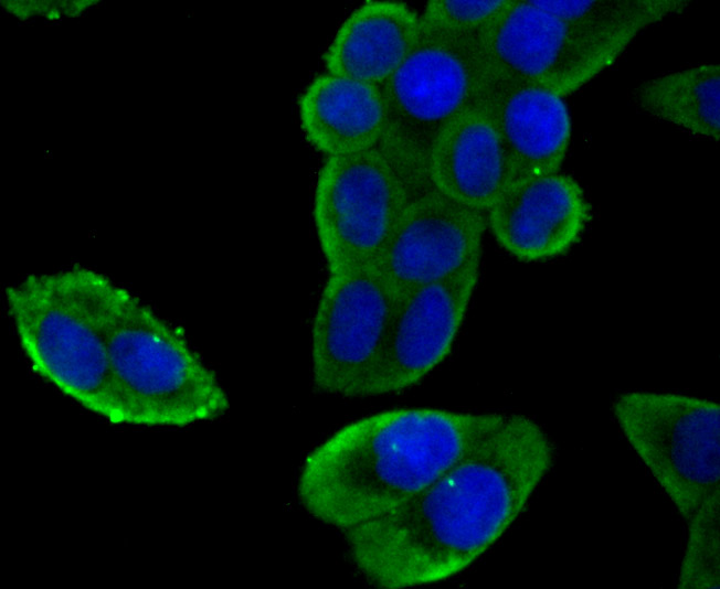 Fig2: ICC staining NaV1.7 (green) in Hela cells. The nuclear counter stain is DAPI (blue). Cells were fixed in paraformaldehyde, permeabilised with 0.25% Triton X100/PBS.
