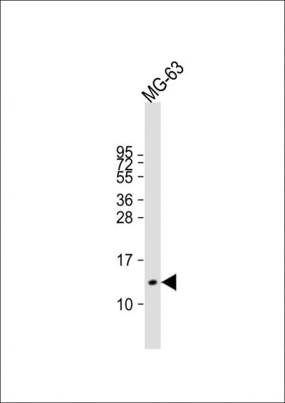 Anti-OSTC Antibody (C16) at 1:2000 dilution + MG-63 whole cell lysatennLysates/proteins at 20 u03bcg per lane.  nnSecondarynGoat Anti-Rabbit IgG,   (H+L),  Peroxidase conjugated at 1/10000 dilution.  nnPredicted band size: 11 kDannBlocking/Dilution buffer: 5% NFDM/TBST.