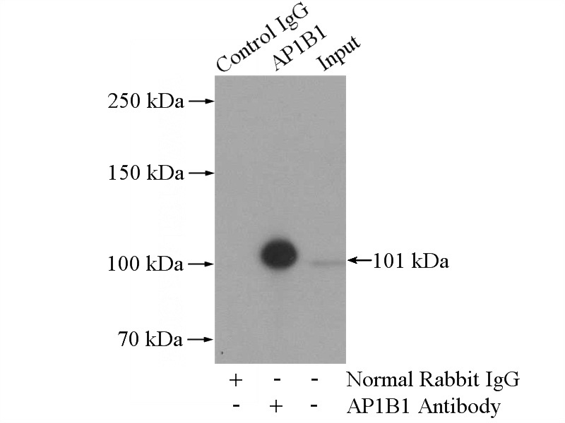 IP Result of anti-AP1B1 (IP:Catalog No:108115, 4ug; Detection:Catalog No:108115 1:500) with HEK-293 cells lysate 2000ug.