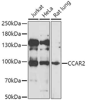 Western blot - CCAR2 Polyclonal Antibody 