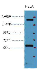 Western blot analysis of Hela, diluted at 1:2000.