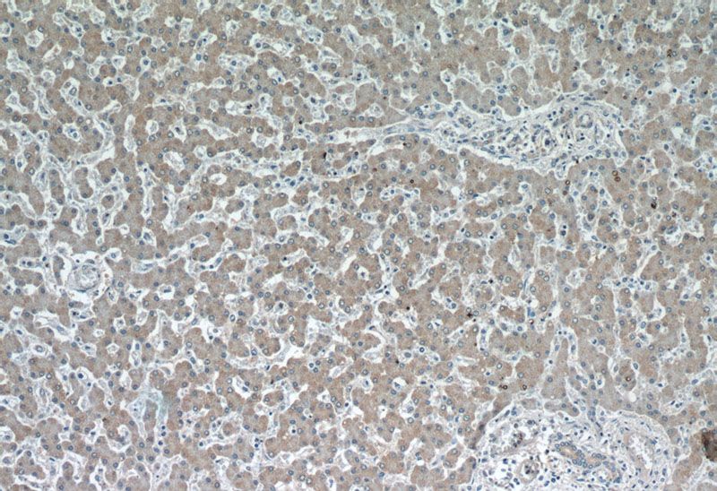 Immunohistochemistry of paraffin-embedded human liver slide using Catalog No:110886(GATC Antibody) at dilution of 1:50