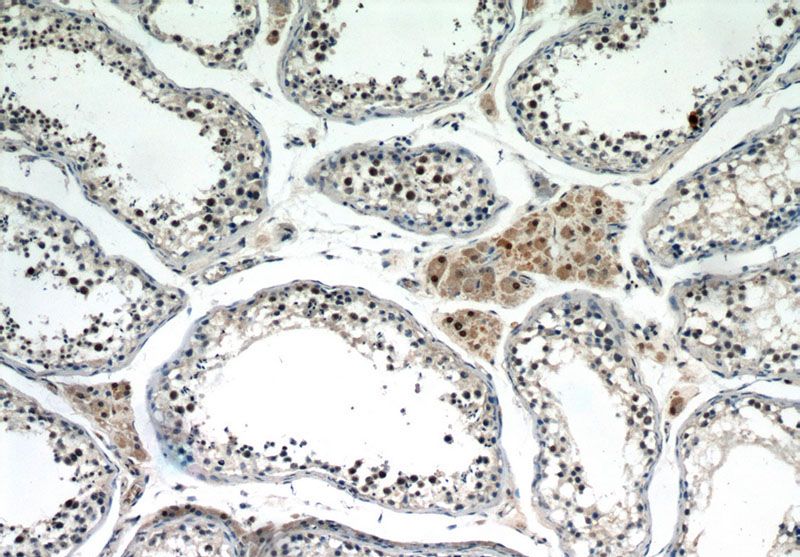 Immunohistochemical of paraffin-embedded human testis using Catalog No:115141(SF4 antibody) at dilution of 1:100 (under 10x lens)