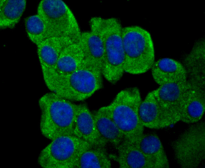 Fig4: ICC staining IL-31 (green) in MCF-7 cells. The nuclear counter stain is DAPI (blue). Cells were fixed in paraformaldehyde, permeabilised with 0.25% Triton X100/PBS.