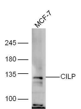 Fig1: Sample:; MCF-7 Cell (Human) Lysate at 30 ug; Primary: Anti-CILP at 1/300 dilution; Secondary: IRDye800CW Goat Anti-Rabbit IgG at 1/20000 dilution; Predicted band size: 132 kD; Observed band size: 132 kD